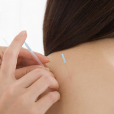 Acupuncture for musculoskeletal pain at our North Vancouver clinic