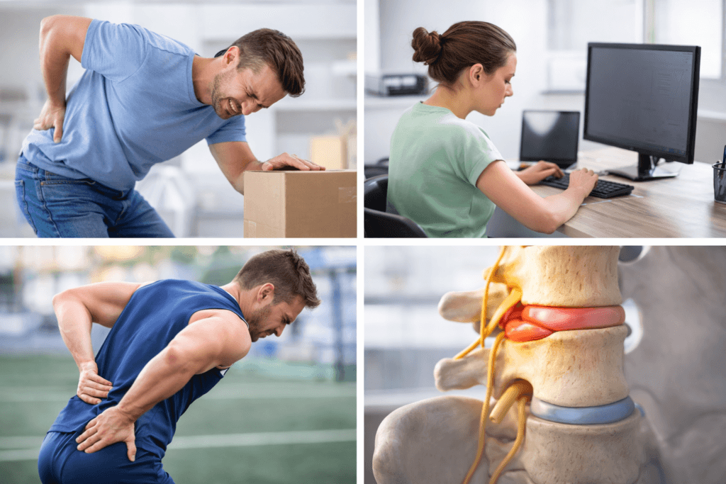 Common Causes of Back Pain